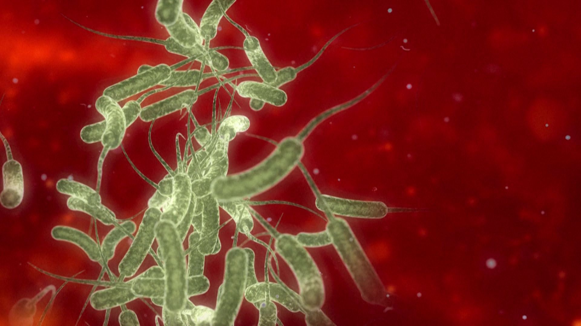 Videografik: Cholera
