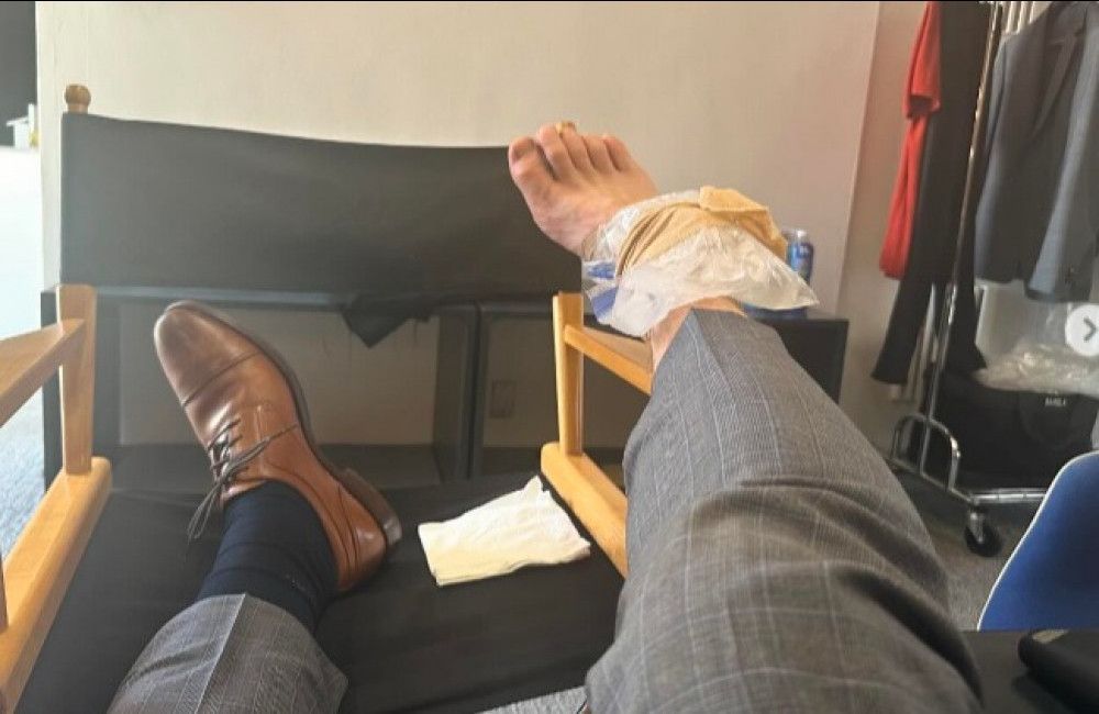 Chris Pratt: Accident with injury on film set