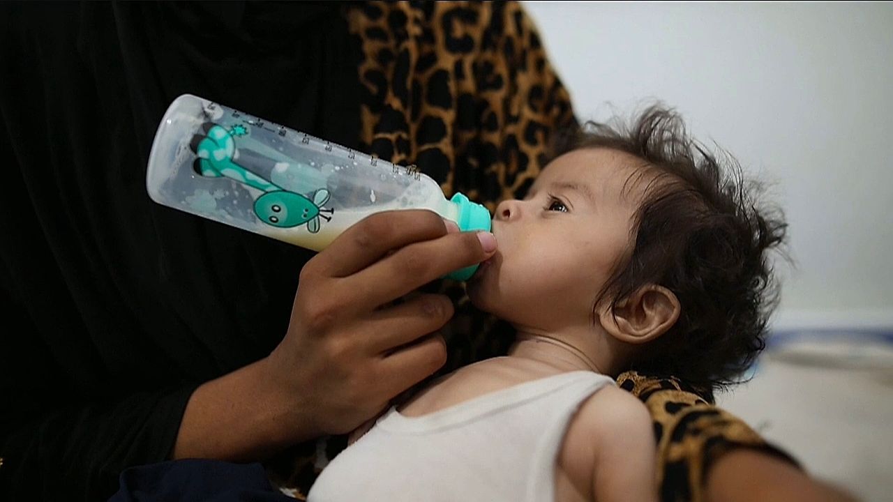 400 Todesfälle bestätigt: WHO warnt vor wachsender Unterernährungskrise in Gaza