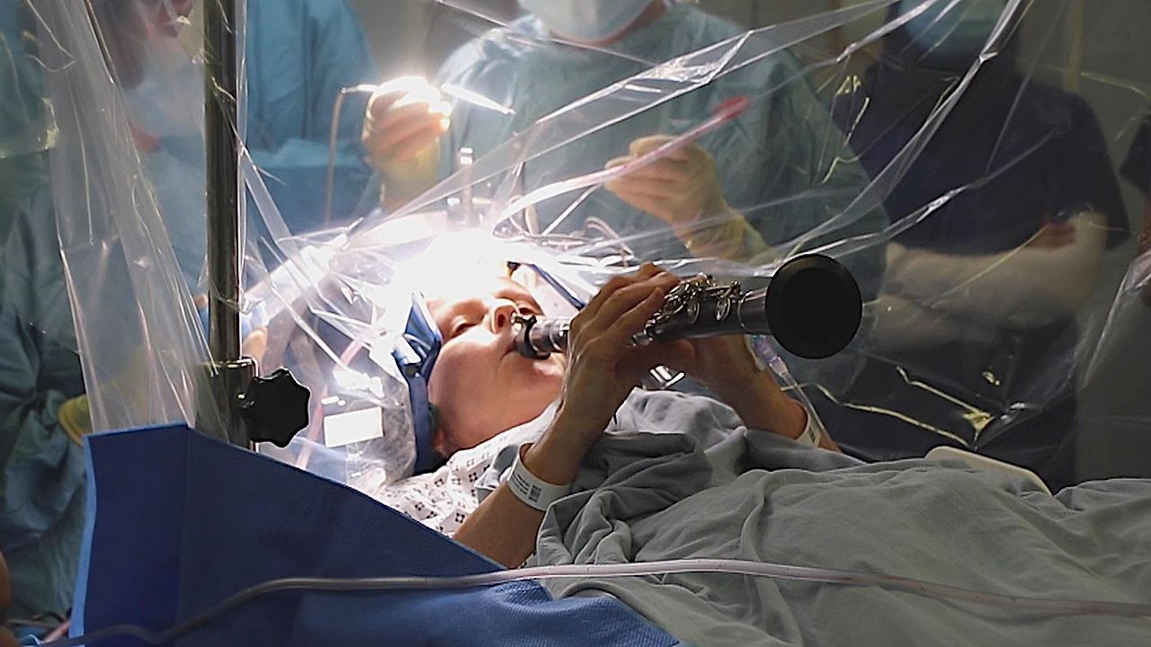 Tiefe Hirnstimulation: Frau mit Parkinson spielt Klarinette während OP