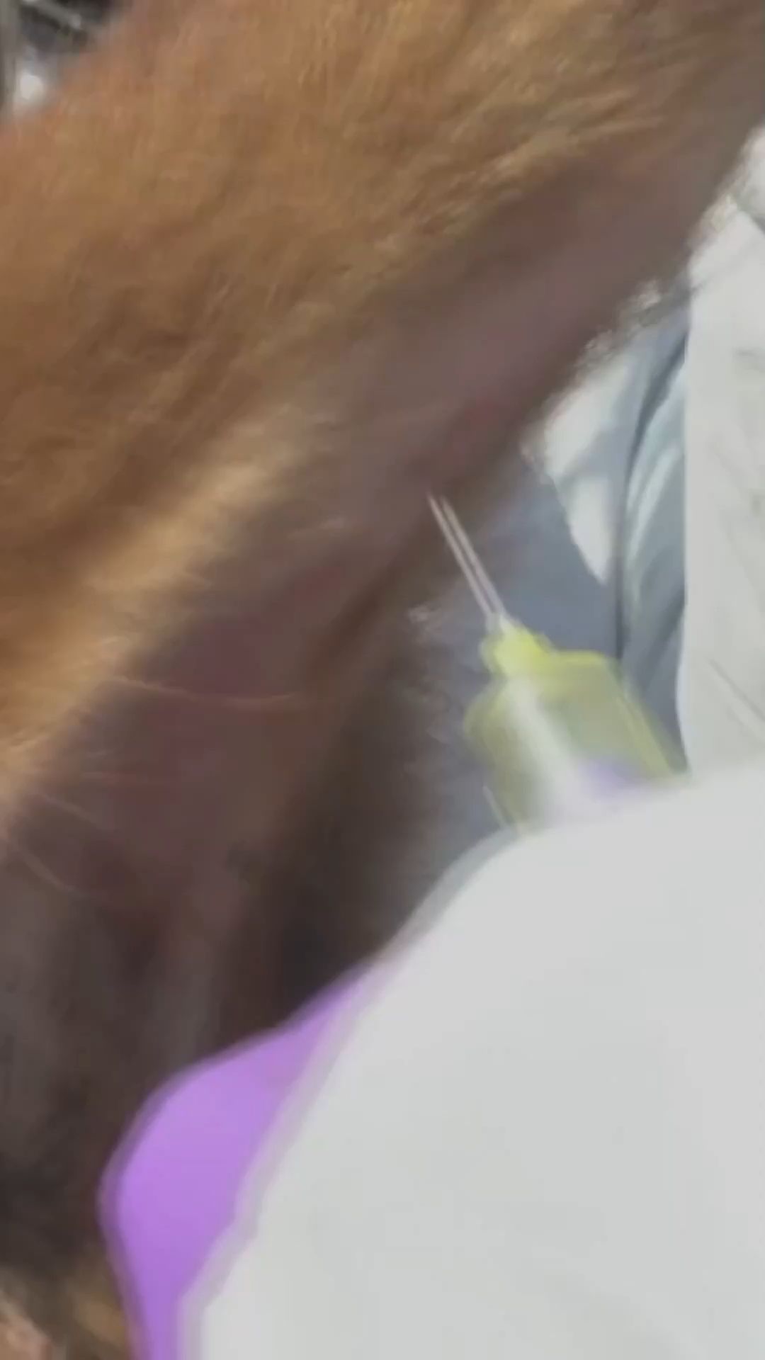 Maul- and Foot-and-Mouth Disease: Is it Dangerous for Humans?