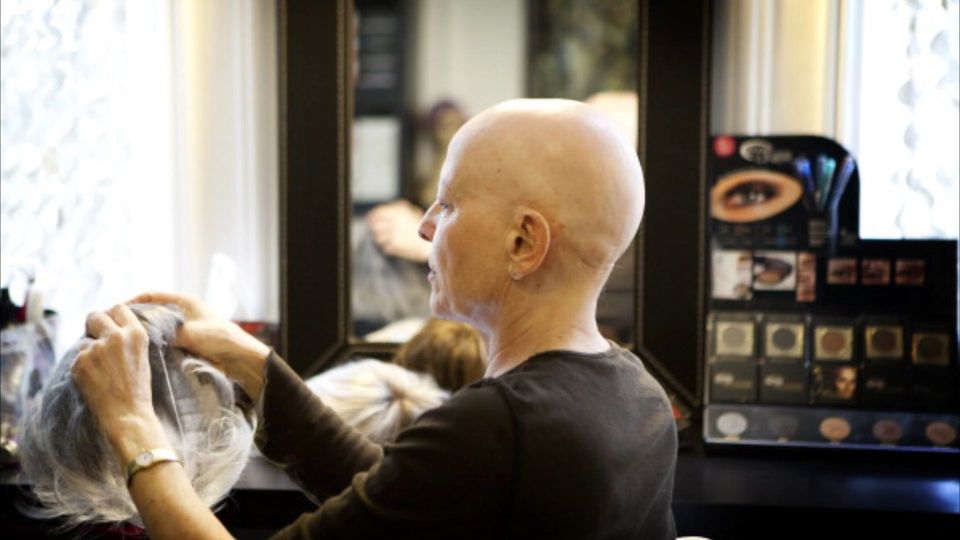 Schluss mit kreisrundem Haarausfall: FDA stellt neues Medikament vor