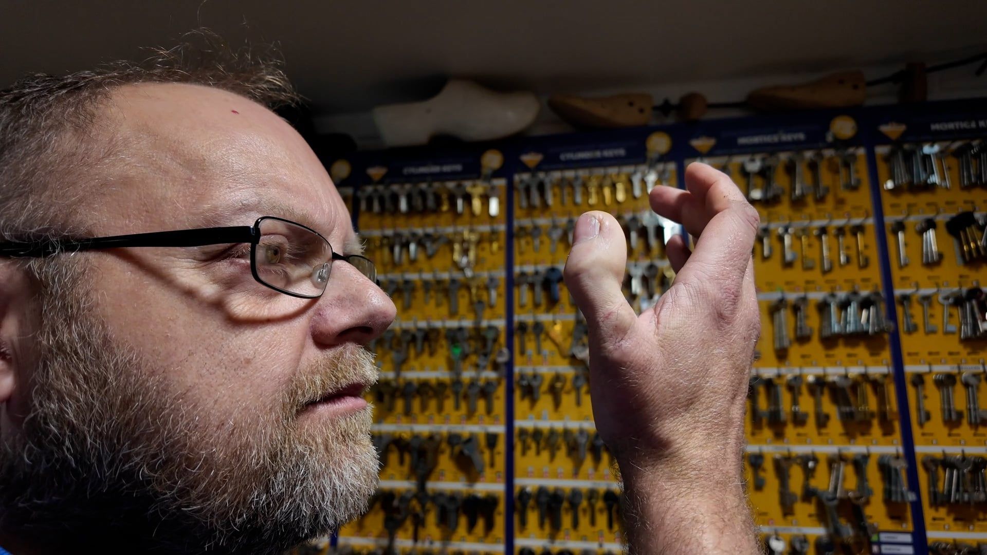 Video: „Mein Daumen ist wie ein großer Zeh – deshalb brauche ich einen größeren Handschuh.“