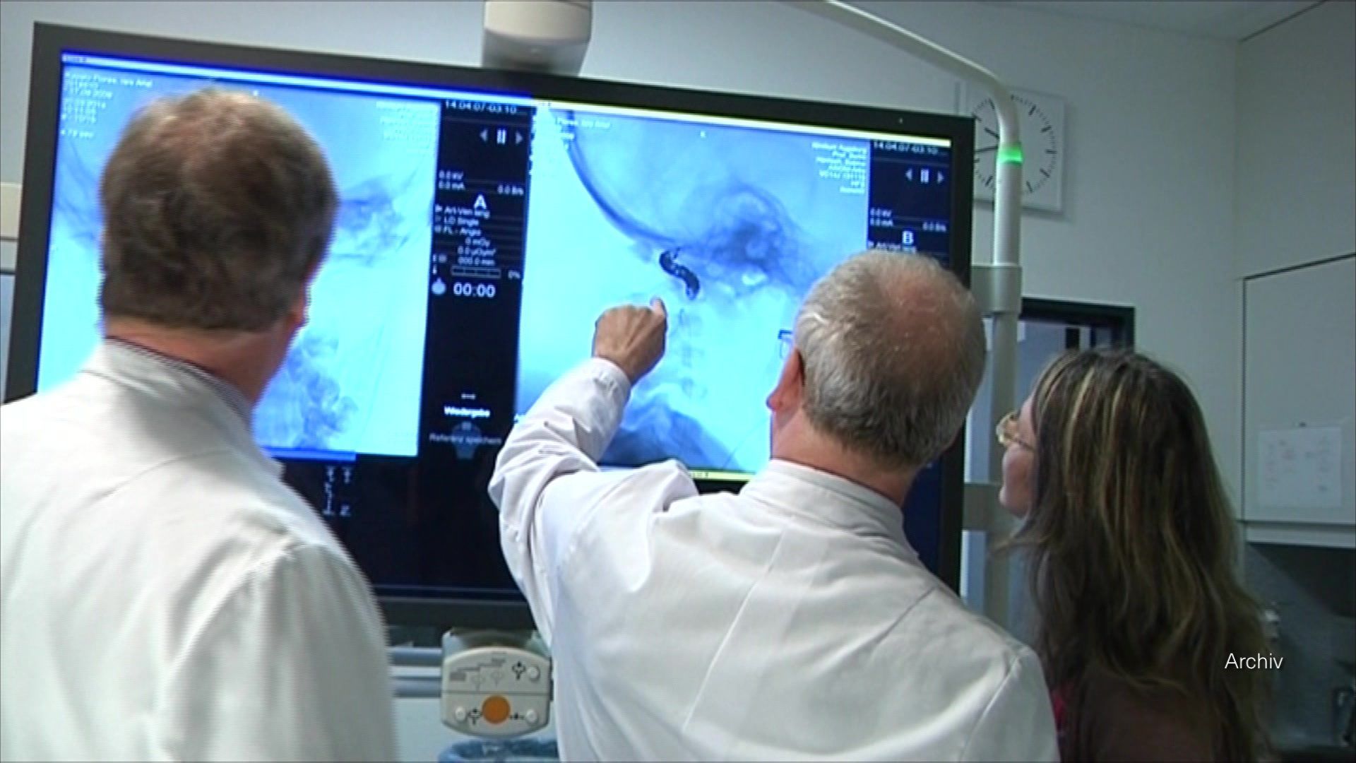 Video: a.tv kompakt: Kreiskliniken Günzburg mit hohem Defizit