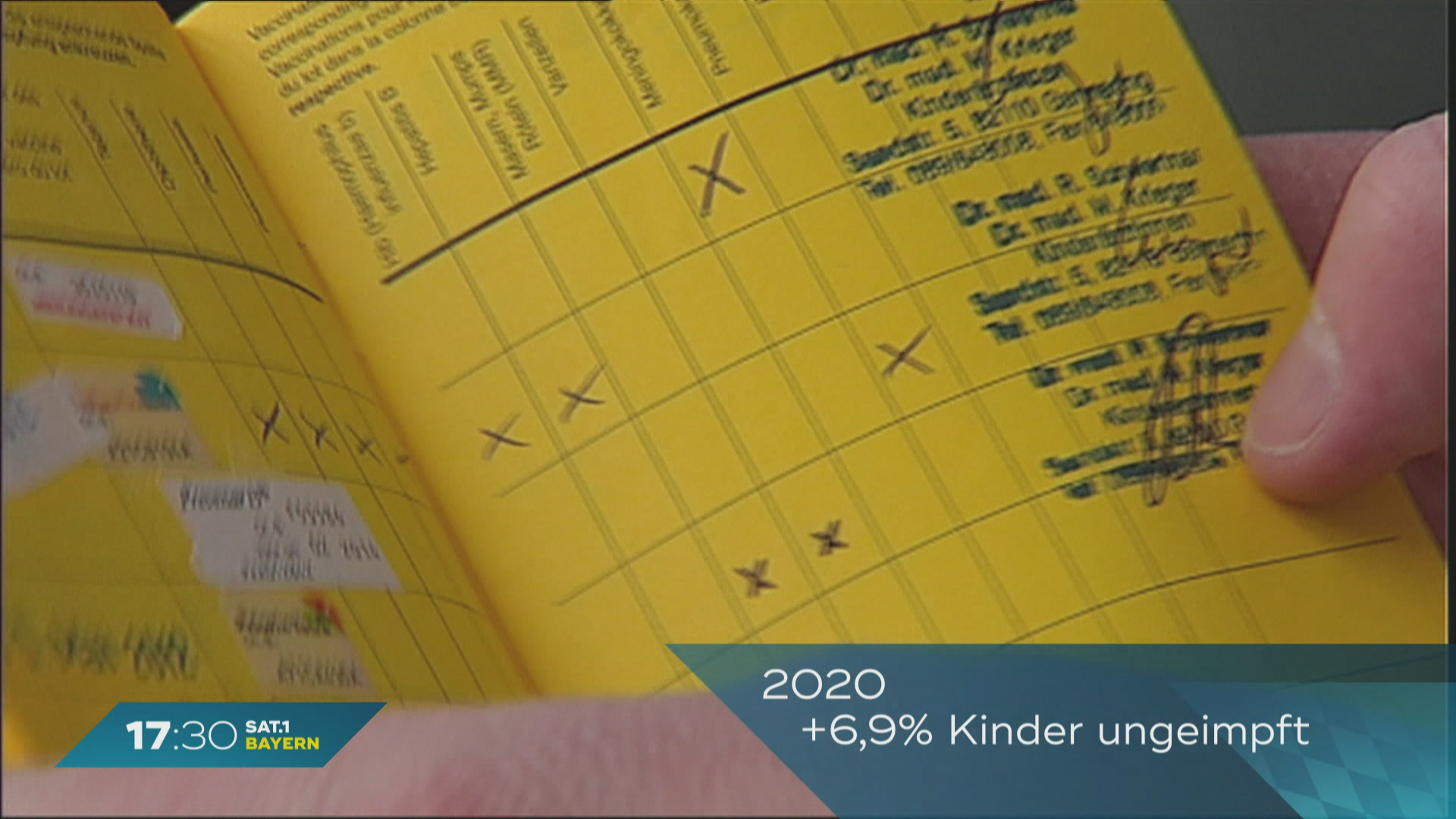 Masern in Bayern: Weniger Impfungen bei Kindern