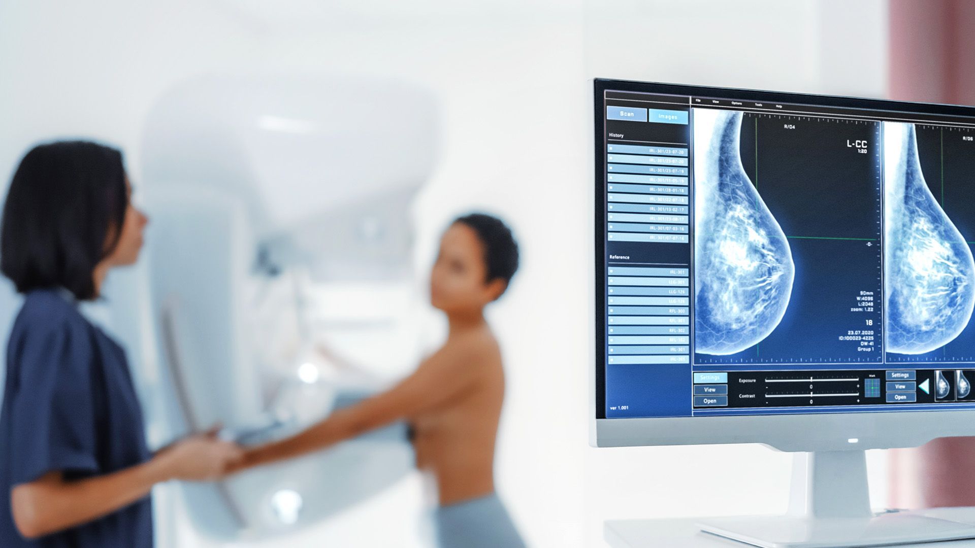 Video: Brustkrebs: Früherkennung rettet Leben