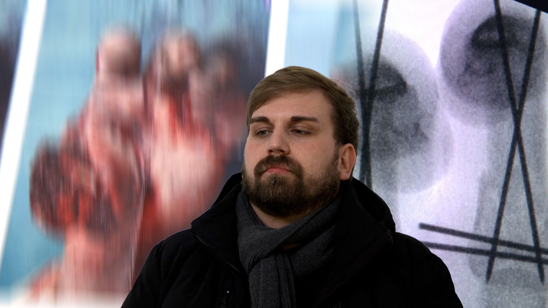 Video: Seine Hand wurde von einem Böller zerfetzt