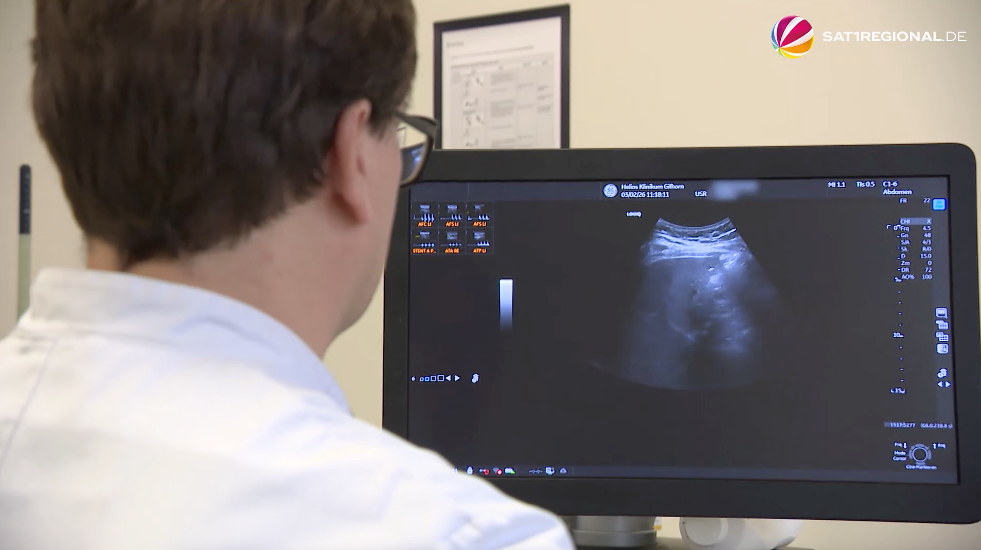 Video: Darmkrebs bei Gifhorner dank Vorsorge erkannt: Früherkennung kann Leben retten