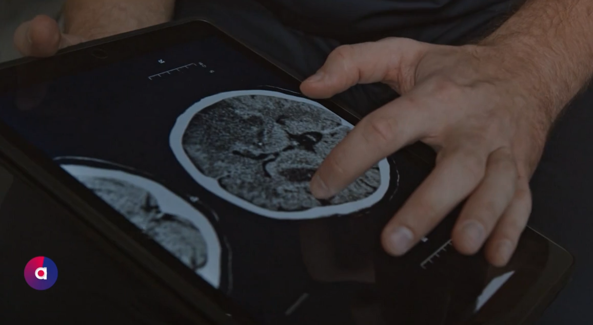 Video: Welt-Krebstag: Betroffene gibt Einblick